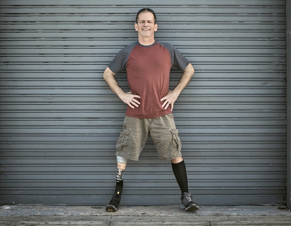 Man Coping with Prosthetic Leg